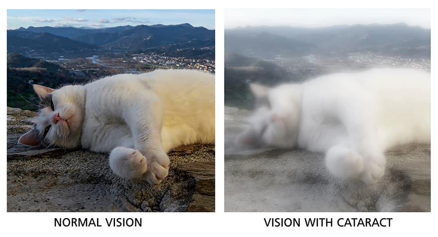 Simulation of vision through cataracts